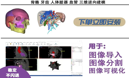 高精度边缘检测与修复